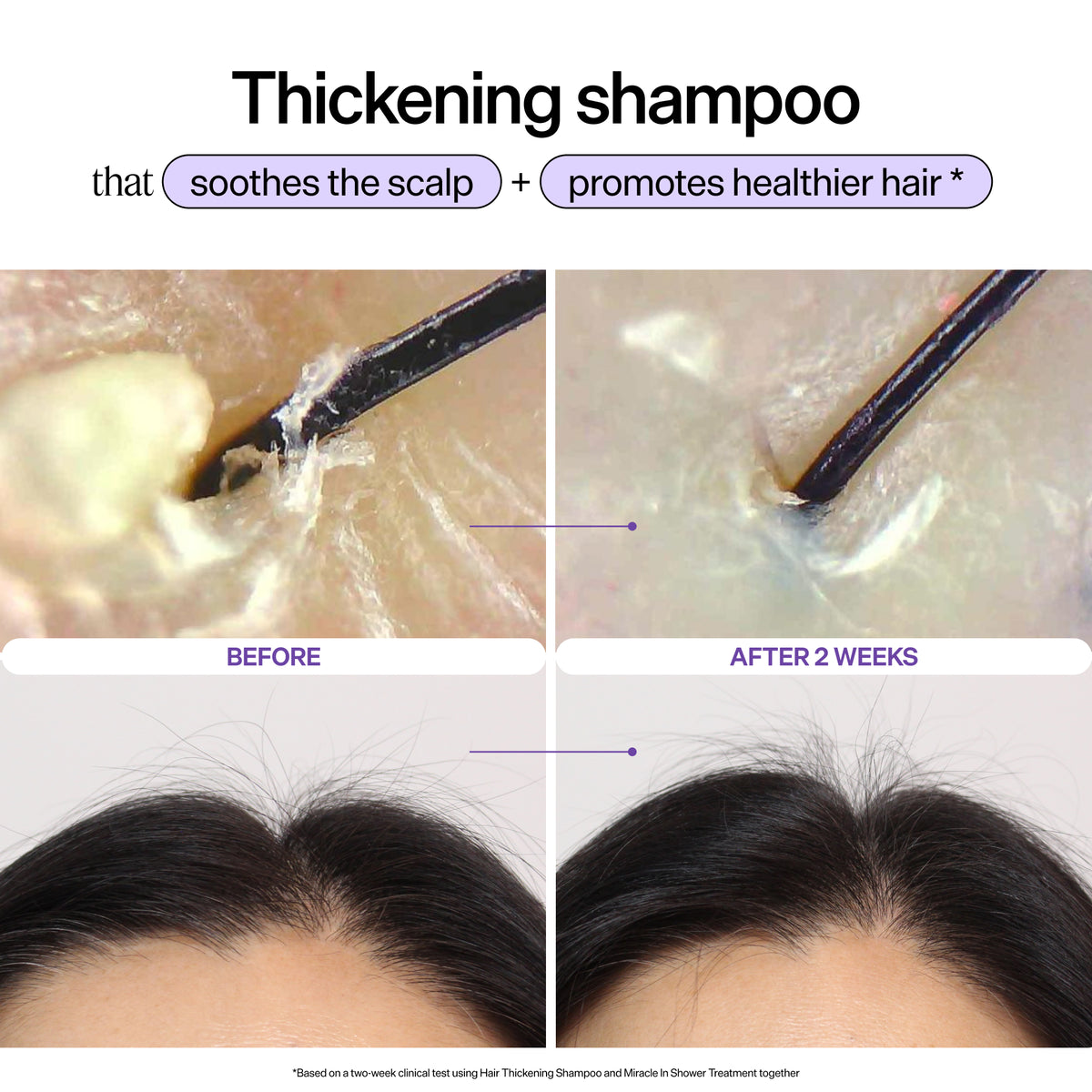 Scalp Revitalizing Solution Hair Thickening Shampoo