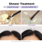 Scalp Revitalizing Solution Miracle in Shower Treatment