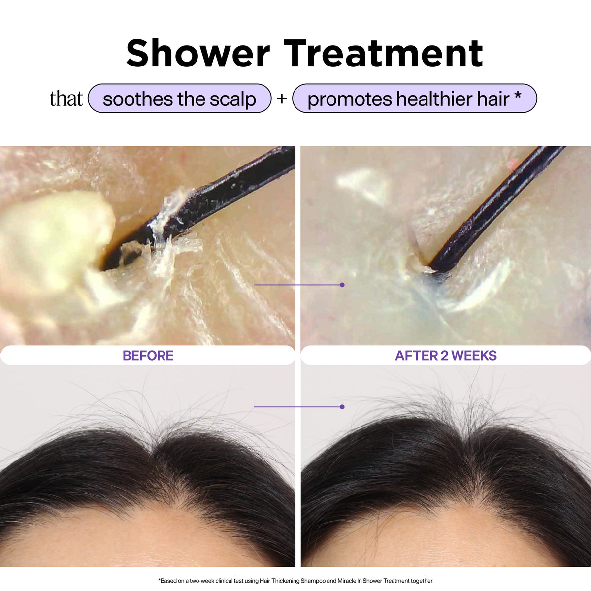 Scalp Revitalizing Solution Miracle in Shower Treatment