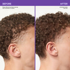Scalp Revitalizing Solution Miracle in Shower Treatment
