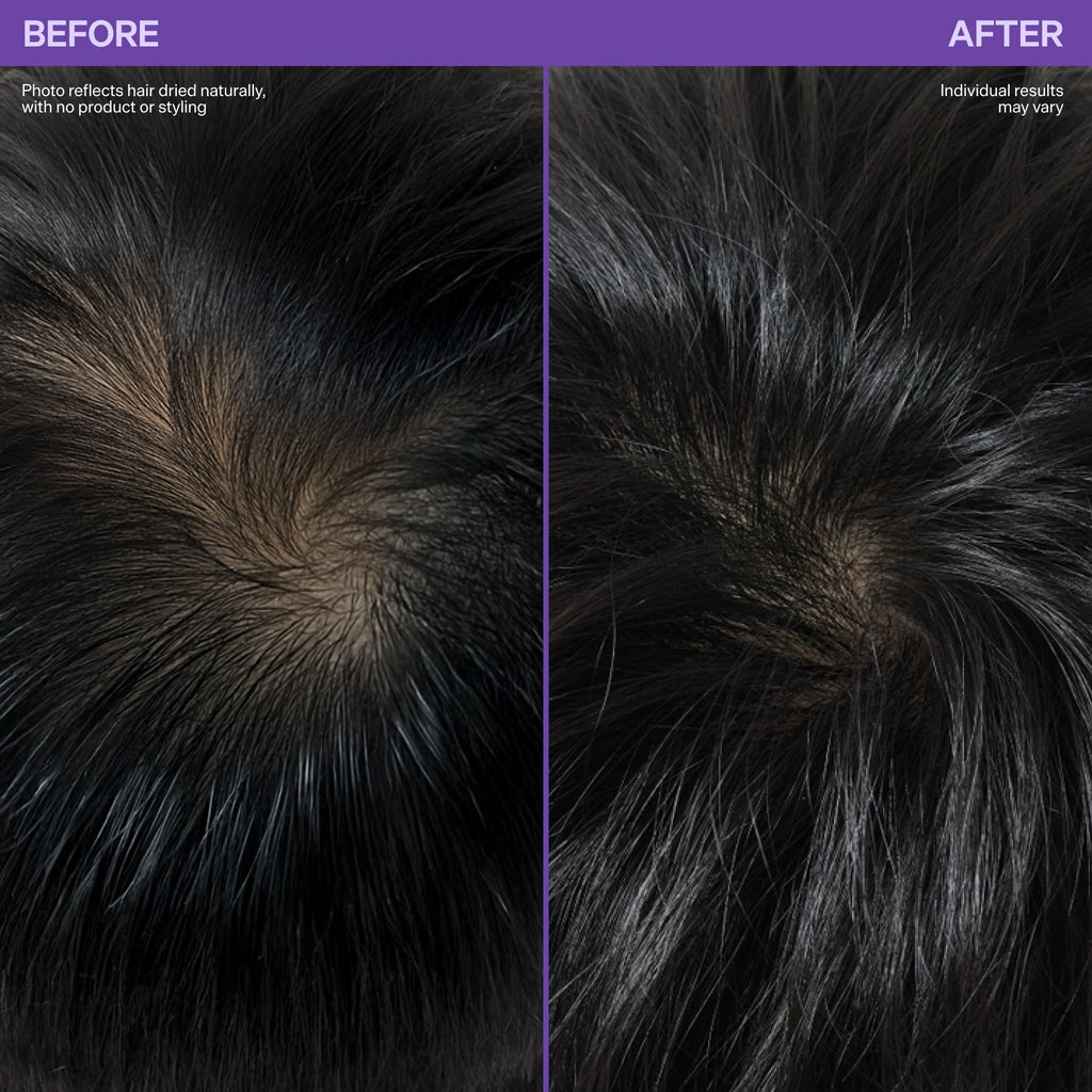 Scalp Revitalizing Solution Hair Thickening Roll On Serum
