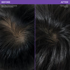 Scalp Revitalizing Solution Hair Thickening Roll On Serum