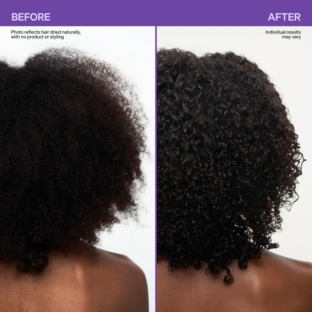 Scalp Revitalizing Solution Scalp Barrier Boost Oil in Serum