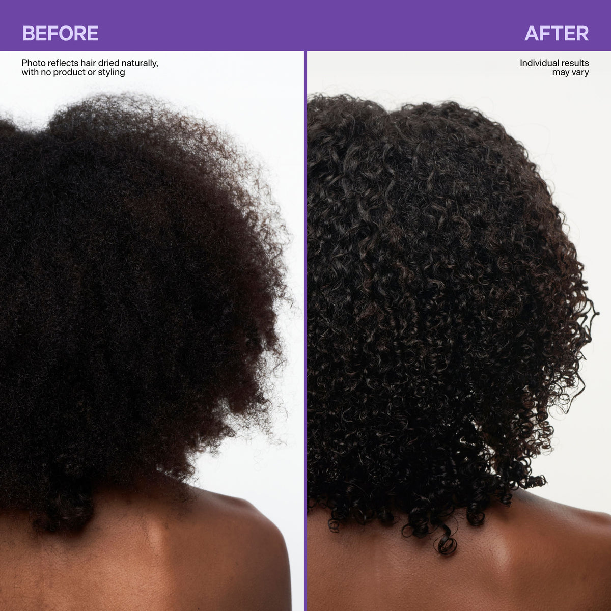 Scalp Revitalizing Solution Scalp Barrier Boost Oil in Serum