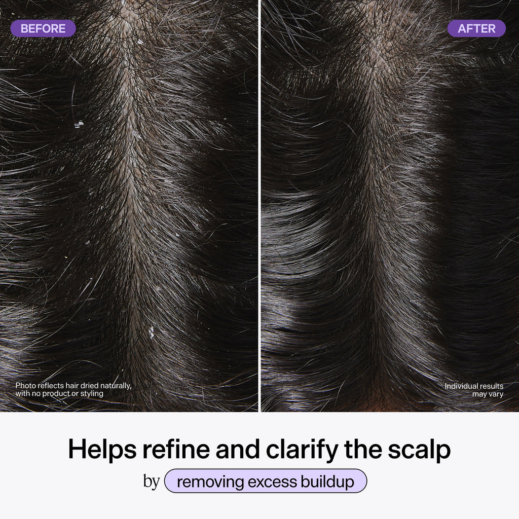 Scalp Revitalizing Solution Scalp Exfoliating Detox Water