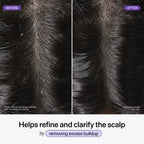 Scalp Revitalizing Solution Scalp Exfoliating Detox Water