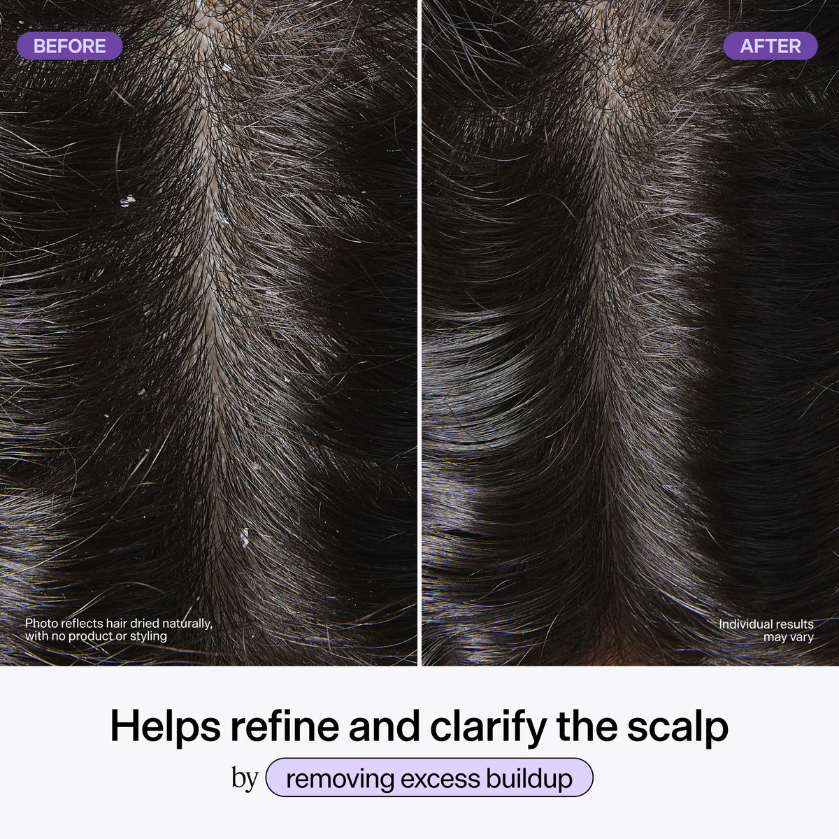Scalp Revitalizing Solution Scalp Exfoliating Detox Water
