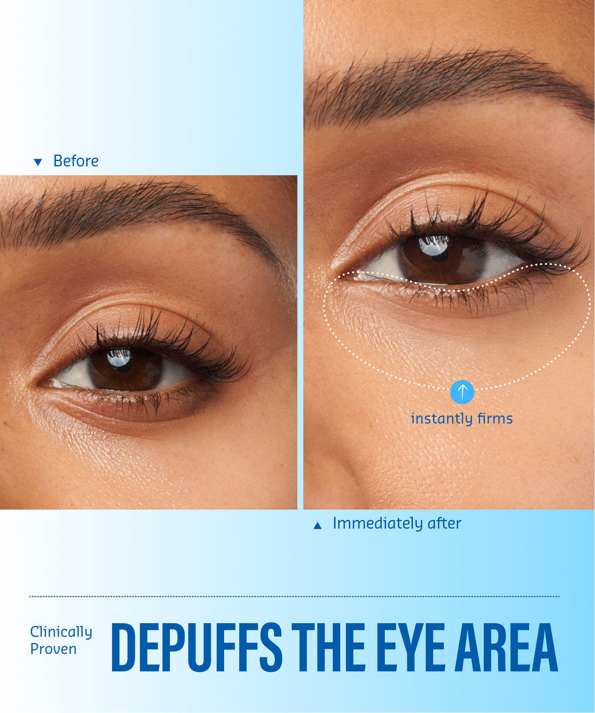 Aqua Bomb Eye Gel