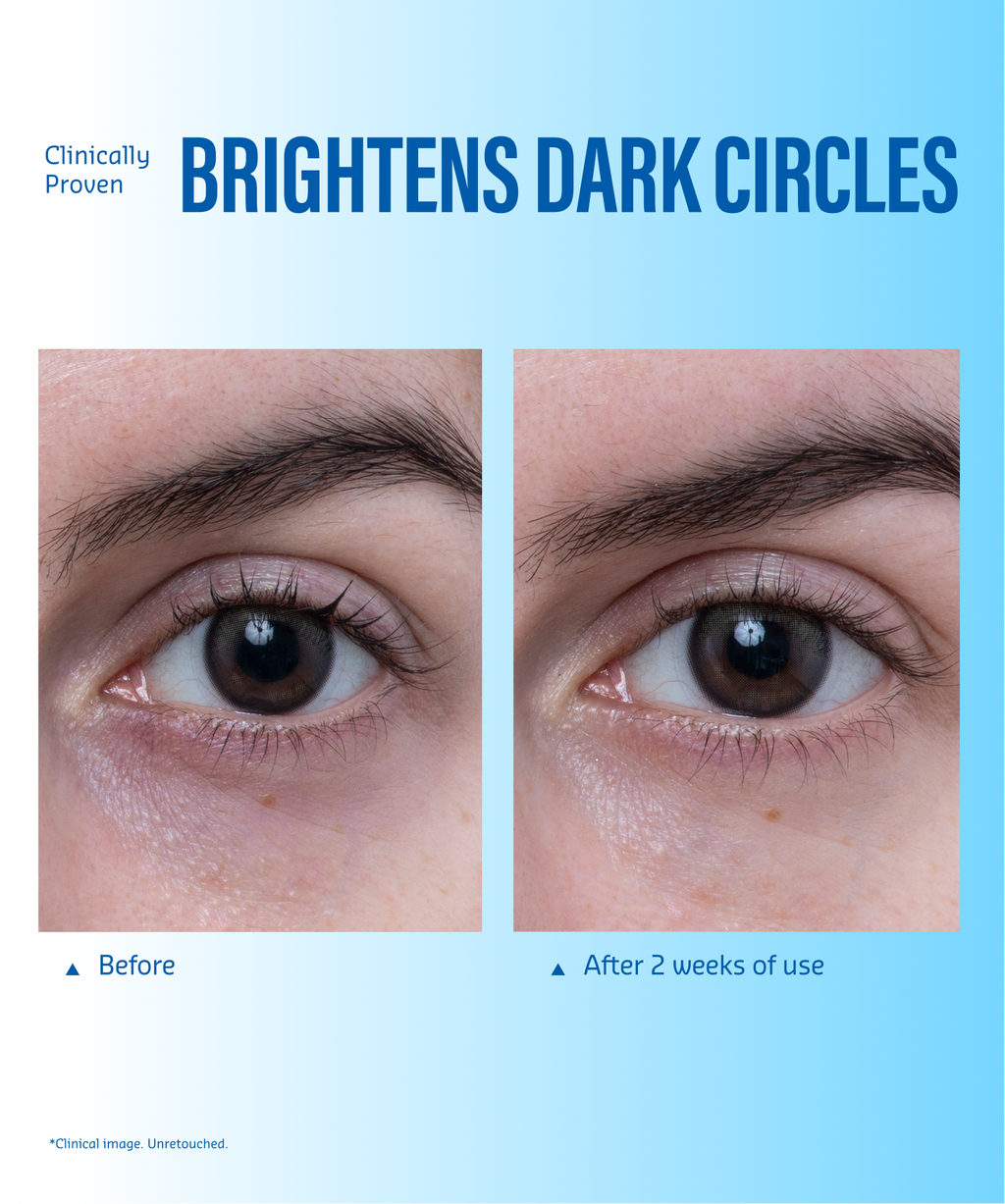 Aqua Bomb Eye Gel