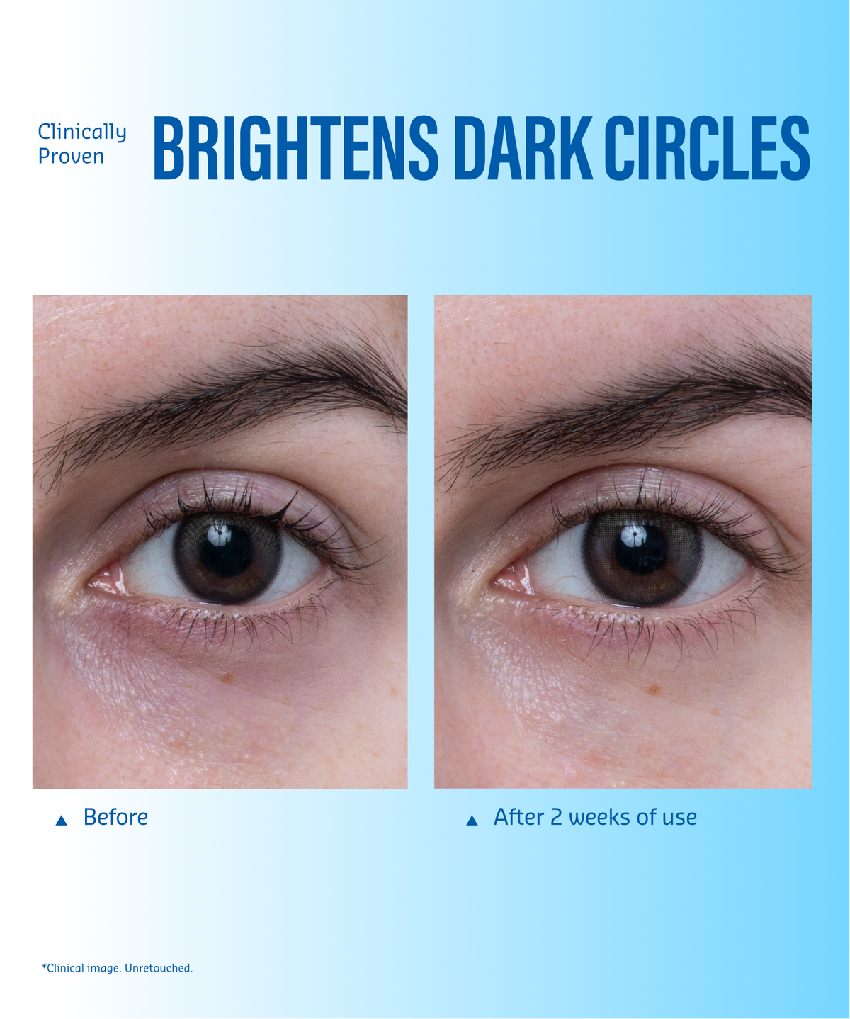 Aqua Bomb Eye Gel