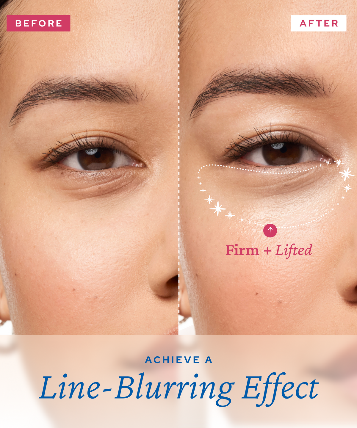 Aqua Bomb Lifting Eye Gel