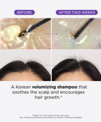 Hair & Scalp Reset Bundle