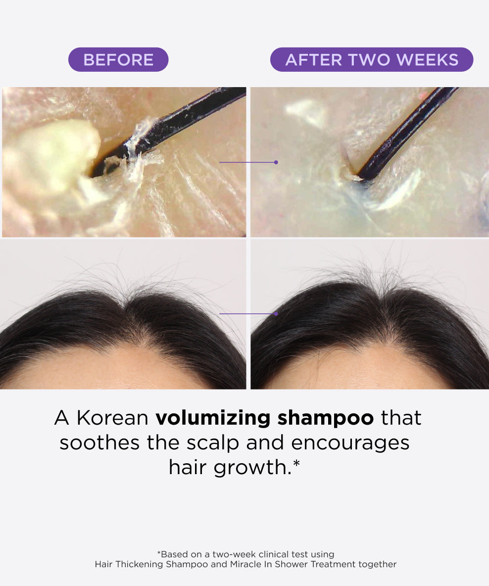 Hair & Scalp Reset Bundle